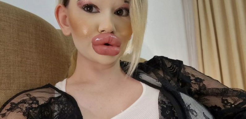 Woman with ‘biggest lips in world’ has many fans offering to fly her on holiday
